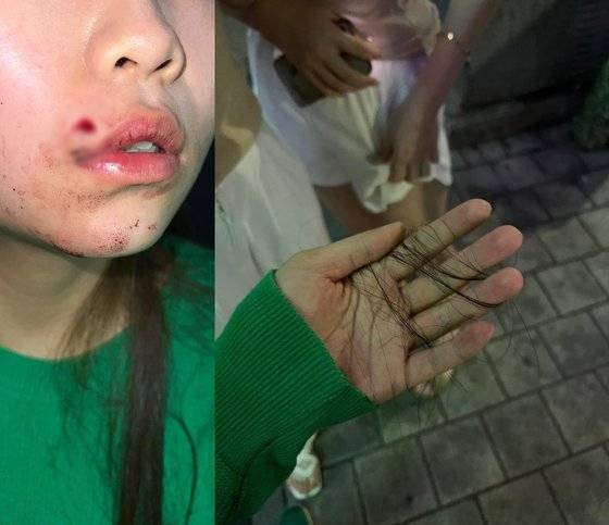 최근 온라인 커뮤니티에는 ″대전의 한 가게에서 자신의 20대 딸이 무차별 폭행을 당했다″고 주장하는 글이 올라왔다. 사진 온라인 커뮤니티