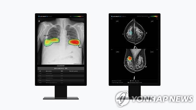 루닛 인사이트 CXR(왼쪽)와 루닛 인사이트 MMG [루닛 제공. 재판매 및 DB 금지]