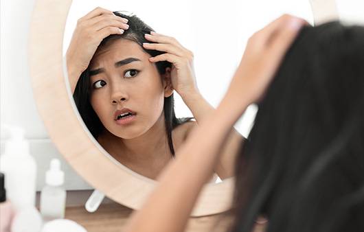 발모광이 심해지면 영구 탈모의 위험성이 높아진다｜출처: 게티이미지뱅크