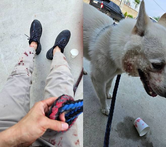 진돗개와 함께 산책을 하던 견주가 목줄이 풀린 핏불테리어의 공격을 받았다./사진=온라인 커뮤니티 캡처,세계일보