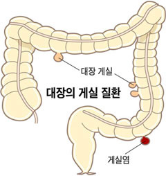 헬스조선 DB