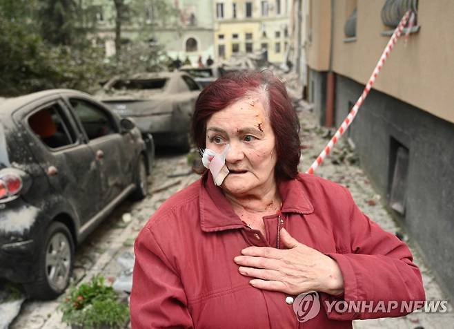 러시아군의 미사일 공습에 다친 르비우 주민 (르비우 AFP=연합뉴스) 6일(현지시간) 러시아군의 미사일 공격을 받은 우크라이나 서부 르비우에서 얼굴을 다친 주민이 당시 상황을 설명하는 모습. 2023.7.6