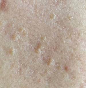 사진=헬스조선DB