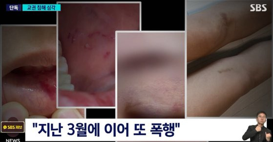 서울의 한 초등학교에서 6학년 학생이 담임교사를 폭행한 사건이 발생했다. 사진 SBS 캡처