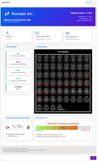 제38호 혁신의료기기로 지정된 뉴냅스의 뇌영상검출·진단보조소프트웨어 '스트로크 온셋 타임 AI(Stroke Onset Time AI)'[사진제공=식품의약품안전처]