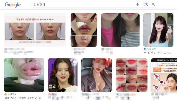 입술 필러를 검색하면 나오는 수많은 사진들