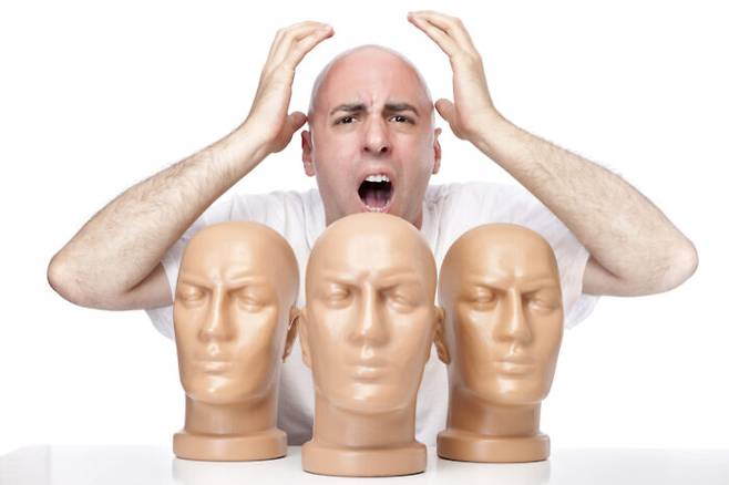 대머리는 모든 남성의 '공공의 적'이다. 그렇다면 세계에서 대머리 남성 비율이 가장 높은 나라는 어디일까? [사진=게티이미지뱅크]