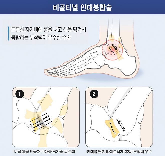 헬스조선DB