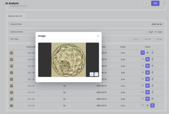 배아 선별 시스템 예시. AI로 배아의 이미지를 분석해 임신 확률이 높은 최적의 배아를 판별할 수 있다.