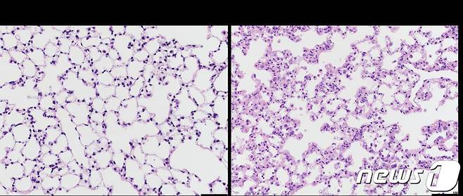 미토콘드리아 기능 저하에 따른 쥐의 폐조직 변화. (한승혜 노스웨스턴대 교수 제공)/뉴스1