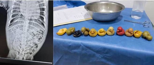 반려견 X-ray(왼쪽), 수술 후 반려견 뱃 속에서 나온 11개의 오리 인형 (사진=뉴욕포스트 캡처) *재판매 및 DB 금지