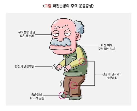 파킨슨병의 주요 증상 [사진 질병관리청]