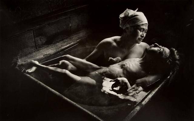 태아 때부터 미나마타병에 걸린 딸 도모코를 안고 있는 엄마의 사진. 사진 작가 유진 스미스가 찍은 미나마타병 관련 사진 중 가장 유명하다.