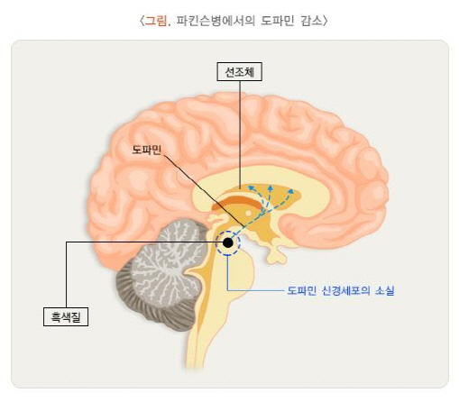 파킨슨병



[출처:질병관리청 국가건강정보포털]