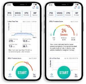 사운더블헬스의 솔루션은 AI가 소변 속도를 분석한다. 의사는 해당 데이터를 보고 병을 진단하는 데 도움을 받을 수 있다. 사운더블헬스 홈페이지 캡처.
