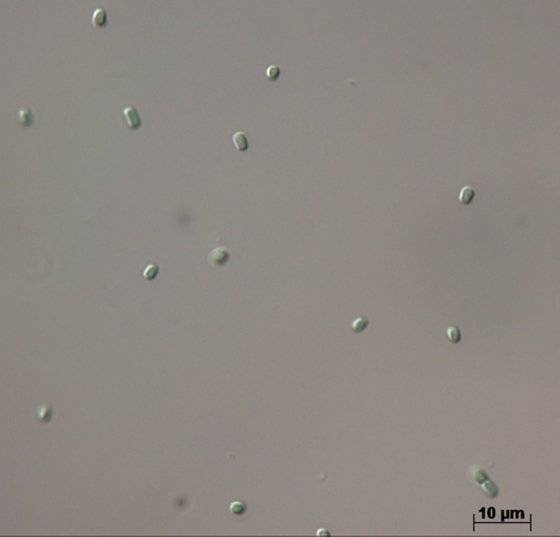 동해에서 비중이 커지고 있는 초미소 식물플랑크톤. 국립수산과학원
