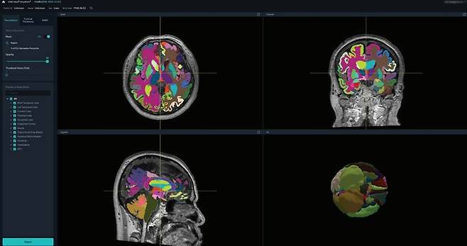 [서울=뉴시스] 19일 의료 인공지능(AI) 기업 뷰노는 AI 기반 뇌 정량화 의료기기 뷰노메드 딥브레인 관련 기술 2건에 대한 특허가 등록 결정됐다고 밝혔다. (사진=뷰노 제공) 2023.10.19. photo@newsis.com *재판매 및 DB 금지