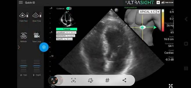 AI 심장초음파 분석화면(셀바스 제공)