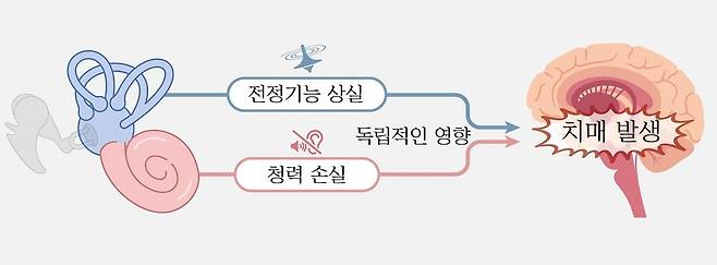 고려대안산병원 연구진이 몸의 균형을 잡는 전정기능과 청력에 이상이 있다면 치매가 발생할 위험이 높다는 사실을 알아냈다./고려대안산병원