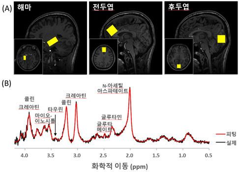 한국기초과학지원연구원은 우울증 질환의 젊은 여성 뇌의 해마에서 타우린 농도가 현저히 감소하는 것을 확인했다. 7T MRI로 촬용한 뇌와 해마의 타우린 신호



기초지원연 제공