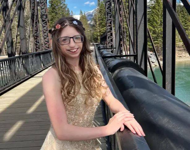 ​트리처 콜린스 증후군을 앓고 있는 아나 크리자노프스키의 모습.​/사진=더 선 캡처​