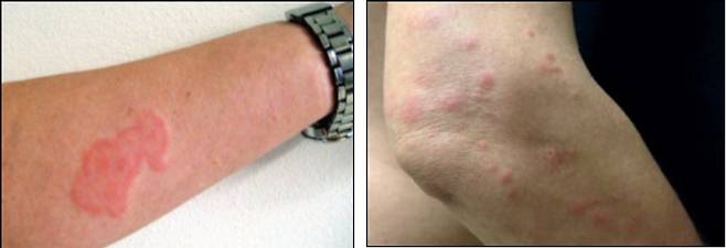 [질병관리청 제공]