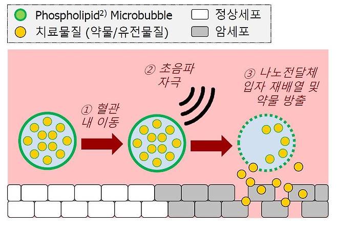 초음파로 약물전달을 돕는 원리./아이엠지티