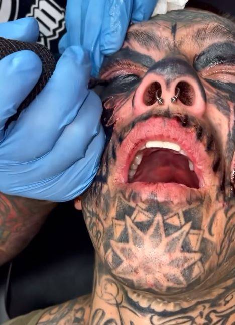 퀘스트 글리포드가 눈동자 문신을 받는 모습./사진=인스타그램 ‘questg’ 캡처