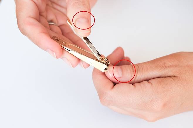 손톱은 우리 몸 상태를 보여주는 건강 지표다. 그래서인지 손톱 밑 반달 모양으로 된 흰 부분이 클수록 건강한 손톱이라고 생각하는 이들도 많다. 사실일까?[사진=게티이미지뱅크]