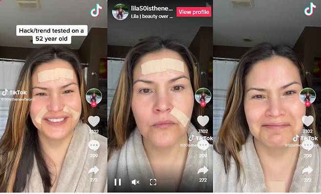 입가나 이마에 테이핑을 해서 주름을 편다는 페이스 테이핑은 소셜미디어 '틱톡'에서도 한동안 유행한 콘텐츠였다. 페이스 테이핑으로 주름이 펴진 모습을 공개한 52세의 틱톡커 @lila50isthenewfword 틱톡 캡처_베리웰헬스 보도 ]