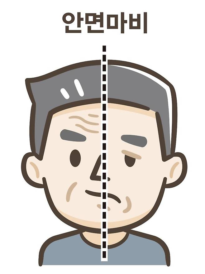 "급성 안면마비, 당뇨병이 발병 시발점일 수도"