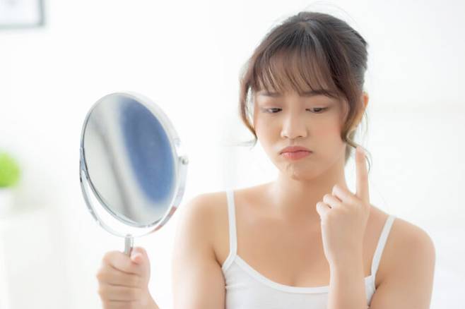 베개 자국은 왜 생길까? 아침에 일어난 뒤 베개 자국이 빨리 사라지지 않을 때가 있다. [사진=게티이미지뱅크]
