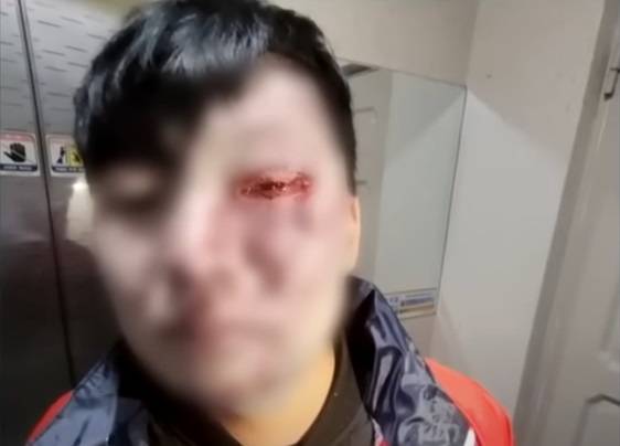 술 주문으로 규정상 신분증을 요구했다가 손님에게 폭행을 당한 20대 배달원이 전치 6주의 부상을 당했다. [사진출처 = JTBC]