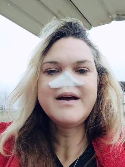 티나는 구멍을 통해 숨을 쉴 수 있지만, 호흡을 따뜻하고 촉촉하게 하기 위해 패치를 사용한다. [사진='더선' 보도내용 캡처]