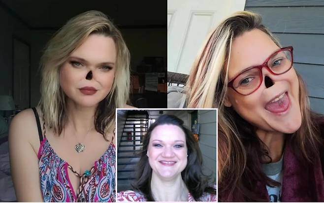 다섯 아이의 엄마인 티나 얼스는 암으로 코를 완전히 잃었지만 그 어느 때보다 자신감이 넘친다. 하단 사진이 코를 아예 없애기 전 티나의 얼굴 [사진='영국 일간 더선' 보도내용 캡처 갈무리]