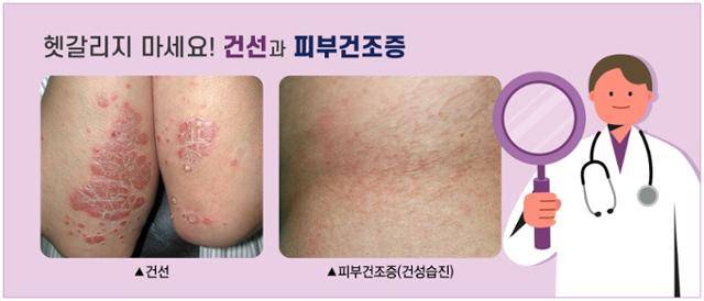강동경희대병원 제공