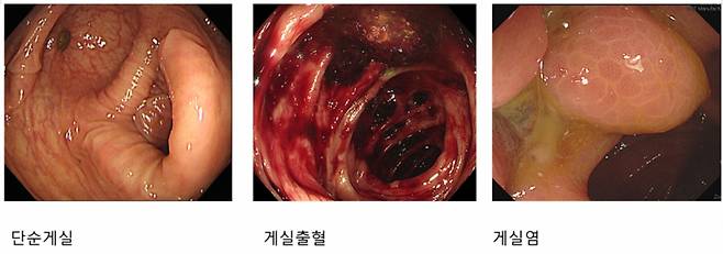 /사진=이태희 순청향대서울병원 교수
