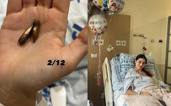 에덴 램 중위의 몸에서 나온 탄환의 일부와 병원에 누워있는 모습