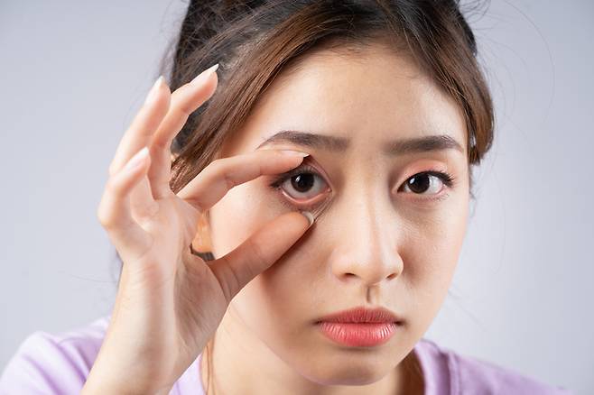 다래끼가 났는데 병원에 갈 수 없는 상황이라면, 소염진통제 등을 이용해볼 수 있다. /게티이미지뱅크