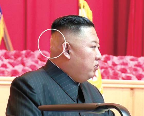 김정은이 2021년 7월 전군 지휘관, 정치간부 강습을 주재하면서 뒤통수에 밴드를 붙인 모습. 조선중앙통신. 연합뉴스.