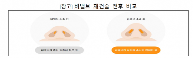 금융감독원