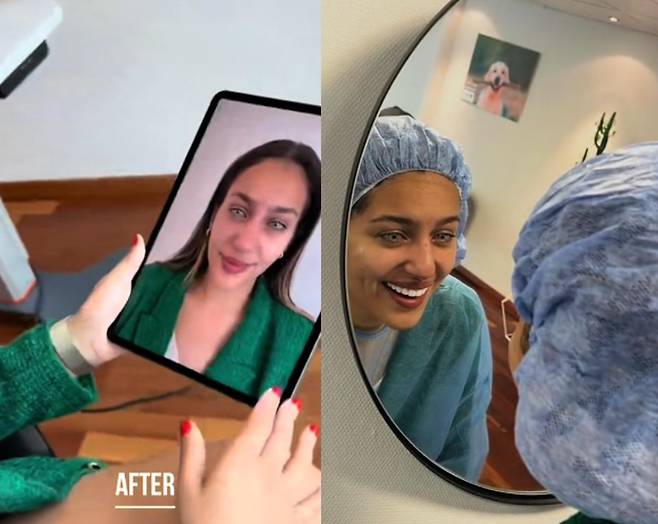 수술 전 여성은 짙은 갈색의 눈동자를 지녔다. 갈색이 아닌 푸른빛의 밝은 눈을 원했던 그는 수술 후 만족하는 듯한 모습을 보였다. [사진=틱톡 'new_color_flaak' 캡처]