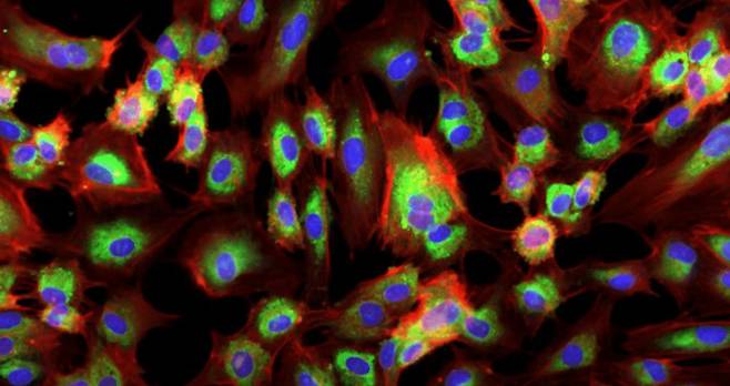 엔비디아가 엔비디아 바이오네모(NVIDIA BioNeMo)를 통해 12개 이상의 생성형 인공지능(AI) 모델과 클라우드 서비스를 제공하고 있다고 11일 밝혔다./엔비디아 제공