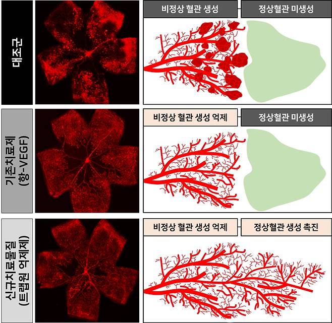 망막병증 치료 활성 비교 [울산과학기술원 제공. 재판매 및 DB 금지]