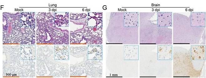 해당 연구에서 실험쥐의 폐(왼쪽)와 뇌 조직에 'GX_P2V 바이러스'가 감염된 모습. [자료=BioRxiv]