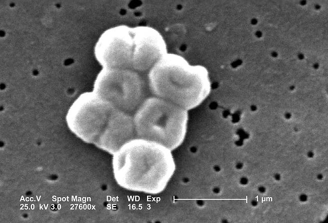 전자 현미경으로 촬영한 아시네토박터 바우마니(Acinetobacter baumannii)균. 대표적인 항생제 내성균 중 하나. / 질병통제예방센터(CDC)