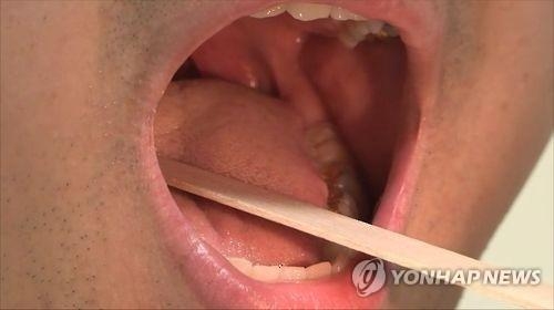 구강검사 [사진 = 연합뉴스]