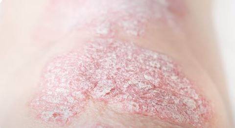 서울대병원 제공