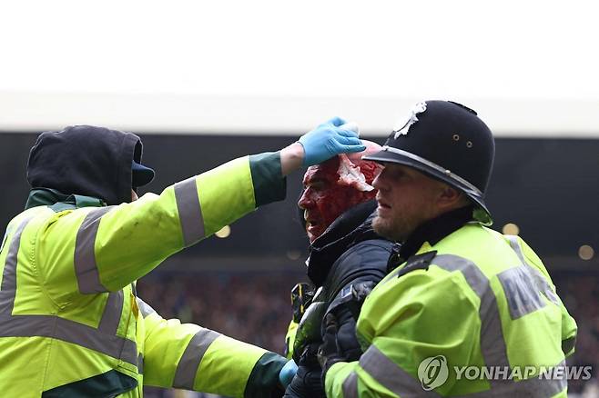 머리에 상처를 입은 관중이 경찰의 보호를 받으며 경기장을 빠져 나가는 모습. [AFP=연합뉴스]