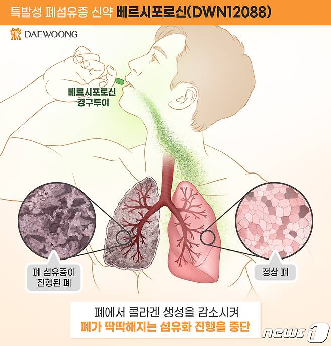 베르시포로신(DWN12088) 작용 기전.(대웅제약 제공)/뉴스1 ⓒ News1